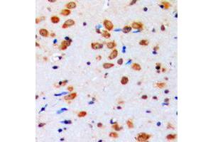 Immunohistochemical analysis of AKT (pY315) staining in human brain formalin fixed paraffin embedded tissue section. (AKT1 Antikörper  (pTyr315))