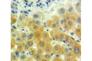 IHC-P analysis of Liver tissue, with DAB staining. (GDF7 Antikörper  (AA 295-447))