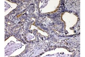 Immunohistochemistry (IHC) image for anti-Nephroblastoma Overexpressed (NOV) (AA 334-357) antibody (ABIN5647955)