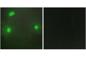Immunofluorescence analysis of HeLa cells, using FEN1 Antibody. (FEN1 Antikörper  (AA 86-135))