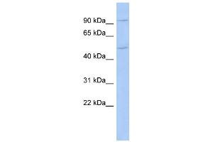 WB Suggested Anti-CXorf6 Antibody Titration:  0. (MAMLD1 Antikörper  (N-Term))