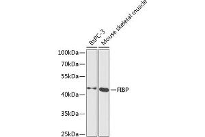 Western blot analysis of extracts of various cell lines, using FIBP antibody  at 1:1000 dilution. (FIBP Antikörper  (AA 1-364))