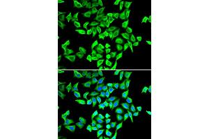 Immunofluorescence analysis of A549 cells using TP53 antibody (ABIN5970093). (p53 Antikörper)