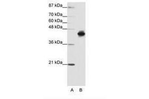 Image no. 1 for anti-Keratin 18 (KRT18) (N-Term) antibody (ABIN203131) (Cytokeratin 18 Antikörper  (N-Term))