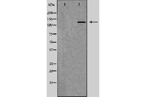 Western blot analysis of Mouse spleen lysate, using ITGAM Antibody. (CD11b Antikörper  (Internal Region))
