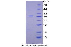 SDS-PAGE (SDS) image for Calcium/calmodulin-Dependent Protein Kinase II gamma (CAMK2G) (AA 75-281) protein (His tag) (ABIN1879729)