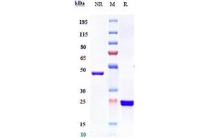 Anti-GP6 / Glycoprotein-6 Reference Antibody (glenzocimab) on SDS-PAGE under reducing (R) condition.