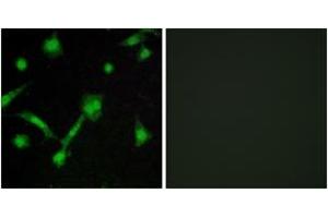 Immunofluorescence analysis of LOVO cells, using IkappaB-alpha (Phospho-Ser32/Ser36) Antibody.