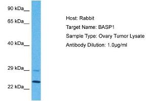 Host: Rabbit Target Name: BASP1 Sample Tissue: Human Ovary Tumor Antibody Dilution: 1ug/ml (BASP1 Antikörper  (N-Term))