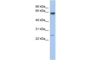Western Blotting (WB) image for anti-TAF5-Like RNA Polymerase II, P300/CBP-Associated Factor (PCAF)-Associated Factor, 65kDa (TAF5L) antibody (ABIN2463889) (TAF5L Antikörper)