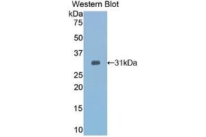 Western blot analysis of recombinant Mouse TOLLIP.