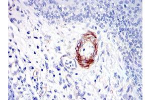 Immunohistochemistry (IHC) image for anti-Discs, Large (Drosophila) Homolog-Associated Protein 1 (DLGAP1) antibody (ABIN969175)