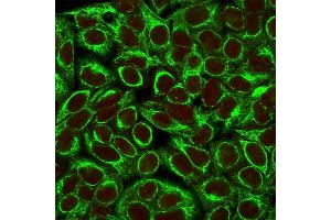 Confocal immunofluorescence image of HeLa cells using Cytokeratin 8 Mouse Monoclonal Antibody (K8/383). (KRT8 Antikörper)