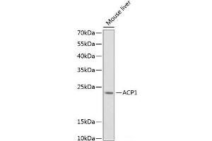 Western blot analysis of extracts of Mouse liver using ACP1 Polyclonal Antibody at dilution of 1:1000. (ACP1 Antikörper)