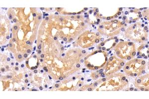 Immunohistochemistry (IHC) image for anti-Caspase 8 (CASP8) (AA 7-201) antibody (ABIN7444115)