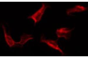 ABIN6267264 staining SK-OV3 by IF/ICC.