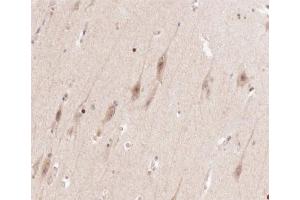 ABIN6266602 at 1/100 staining human brain tissue sections by IHC-P. (ENO2/NSE Antikörper  (C-Term))