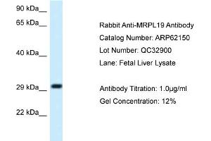 Western Blotting (WB) image for anti-Mitochondrial Ribosomal Protein L19 (MRPL19) (C-Term) antibody (ABIN2774335)