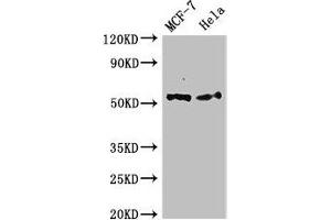 Western Blot Positive WB detected in: MCF-7 whole cell lysate, Hela whole cell lysate All lanes: PTK6 antibody at 2. (PTK6 Antikörper  (AA 1-113))