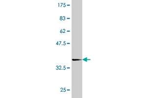 Western Blot detection against Immunogen (35. (TAO Kinase 3 Antikörper  (AA 809-898))
