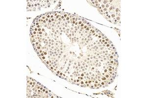 Immunohistochemistry of paraffin embedded rat testis using SCP1 (ABIN7075786) at dilution of 1:500 (300x lens) (SYCP1 Antikörper)