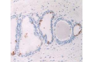 IHC-P analysis of Human Prostate Gland Tissue, with DAB staining. (GREM1 Antikörper  (AA 26-184))