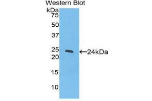 Western Blotting (WB) image for anti-Peroxisome Proliferator-Activated Receptor gamma (PPARG) (AA 311-500) antibody (ABIN3207607) (PPARG Antikörper  (AA 311-500))