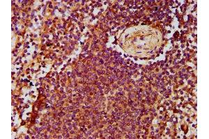 IHC image of ABIN7143386 diluted at 1:500 and staining in paraffin-embedded human spleen tissue performed on a Leica BondTM system. (ADGRE2 Antikörper  (AA 151-323))