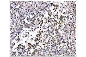 IHC analysis of NDEL1 using anti-NDEL1 antibody (ABIN7602511). (NDEL1 Antikörper  (AA 80-320))