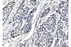 IHC analysis of DLX2 using anti-DLX2 antibody (ABIN7599936). (DLX2 Antikörper  (AA 13-310))