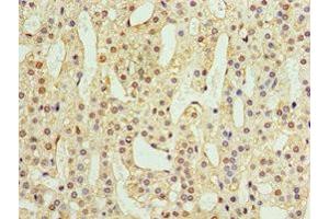Immunohistochemistry of paraffin-embedded human adrenal gland tissue using ABIN7144559 at dilution of 1:100 (ADAP1 Antikörper  (AA 1-374))