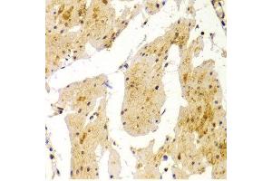 Immunohistochemistry of paraffin-embedded Human esophageal using MVP antibody at dilution of 1:100 (x400 lens). (MVP Antikörper  (AA 1-260))