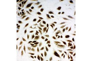 Anti-NM23A antibody, ICC ICC: HELA Cell (NME1 Antikörper  (C-Term))