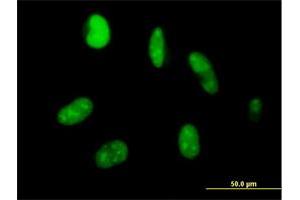 Immunofluorescence of purified MaxPab antibody to ZNF331 on HeLa cell. (ZNF331 Antikörper  (AA 1-463))