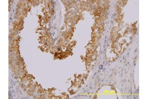 Immunoperoxidase of monoclonal antibody to MARCKSL1 on formalin-fixed paraffin-embedded human testis. (MARCKSL1 Antikörper  (AA 107-195))