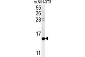 Western Blotting (WB) image for anti-Cellular Retinoic Acid Binding Protein 1 (CRABP1) antibody (ABIN3002339) (CRABP1 Antikörper)