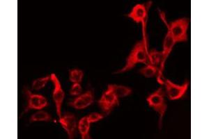 Immunofluorescence (fixed cells) (IF/ICC) image for anti-UDP-Gal:betaGlcNAc beta 1,4- Galactosyltransferase, Polypeptide 5 (B4GALT5) (C-Term) antibody (ABIN6258697)