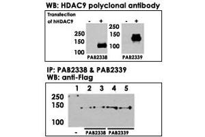 Both HDAC9  and HDAC9  polyclonal antibody were tested by WB and IP-WB using HeLa and HeLa-HDAC9 transfected cells. (HDAC9 Antikörper  (N-Term))
