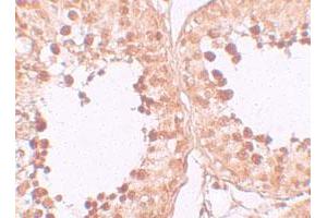 Immunohistochemical staining of human testis cells with CRISP2 polyclonal antibody  at 10 ug/mL.