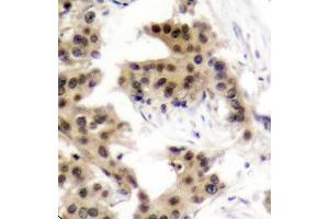 Immunohistochemistry (IHC) image for anti-Nuclear Factor of kappa Light Polypeptide Gene Enhancer in B-Cells 1 (NFKB1) (pSer893) antibody (ABIN1870468) (NFKB1 Antikörper  (pSer893))