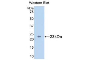 Western blot analysis of the recombinant protein. (PYGL Antikörper  (AA 633-820))