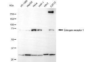 Western blotting analysis using estrogen receptor 1 antibody (ABIN7798492).