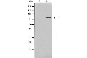 Western blot analysis on MDA-MB-435 cell lysate using MMP15 Antibody. (MMP15 Antikörper  (C-Term))