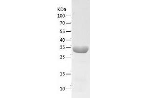 Western Blotting (WB) image for ADP-Ribosylation Factor-Like 5B (ARL5B) (AA 1-299) protein (His tag) (ABIN7121749)