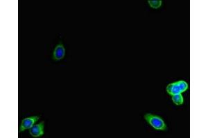 Immunofluorescent analysis of HepG2 cells using ABIN7157938 at dilution of 1:100 and Alexa Fluor 488-congugated AffiniPure Goat Anti-Rabbit IgG(H+L) (LTBP4 Antikörper  (AA 977-1180))