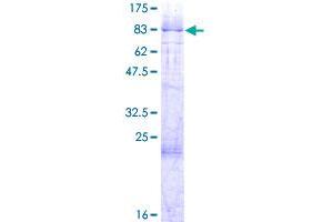 Image no. 1 for PHD Finger Protein 1 (PHF1) (AA 1-567) protein (GST tag) (ABIN1314873) (PHF1 Protein (AA 1-567) (GST tag))