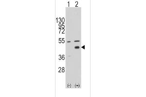 Western blot analysis of WIF1 (arrow) using rabbit polyclonal WIF1 Antibody (N-term) (ABIN389184 and ABIN2839347). (WIF1 Antikörper  (N-Term))
