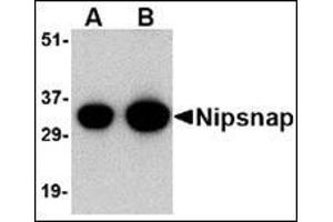 Western blot analysis of NIPSNAP in human brain tissue lysate with this product at (A) 0. (NIPSNAP1 Antikörper  (C-Term))