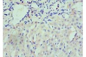 Immunohistochemistry of paraffin-embedded human liver tissue using ABIN7161434 at dilution of 1:100 (Neuropilin 1 Antikörper  (AA 684-923))