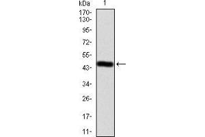 Western blot analysis using EZR mAb against human EZR (AA: 292-464) recombinant protein. (Ezrin Antikörper  (AA 292-464))